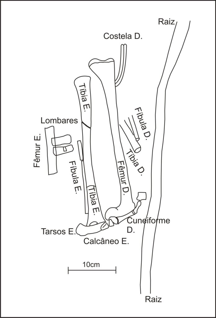 Qual o CID da coluna lombar e cervical?