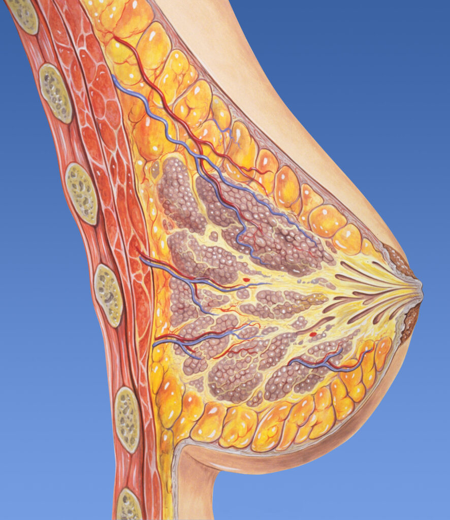 O que é uma neoplasia benigna do ovário?